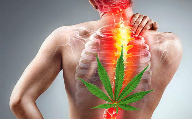 Снятие воспаления с помощью каннабиса